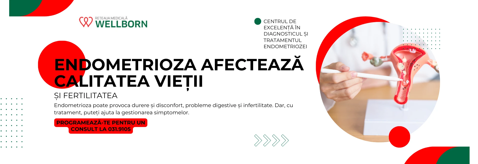 endometrioza 2025